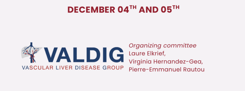 Paris PSVD Meeting